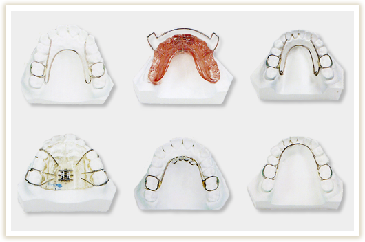 混合歯列期の矯正治療に使用する器具の写真